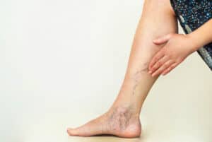 Laser Hair Removal | Canterbury Skin and Laser Clinic