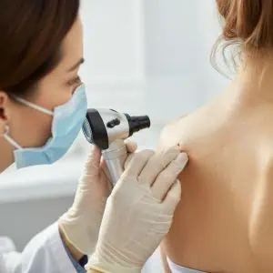 mole check Kent